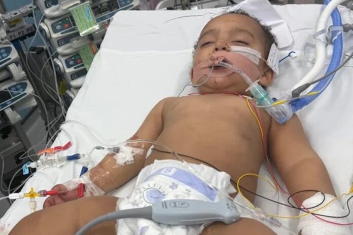 bebe-perde-metade-da-lingua-apos-confundir-soda-caustica-com-leite