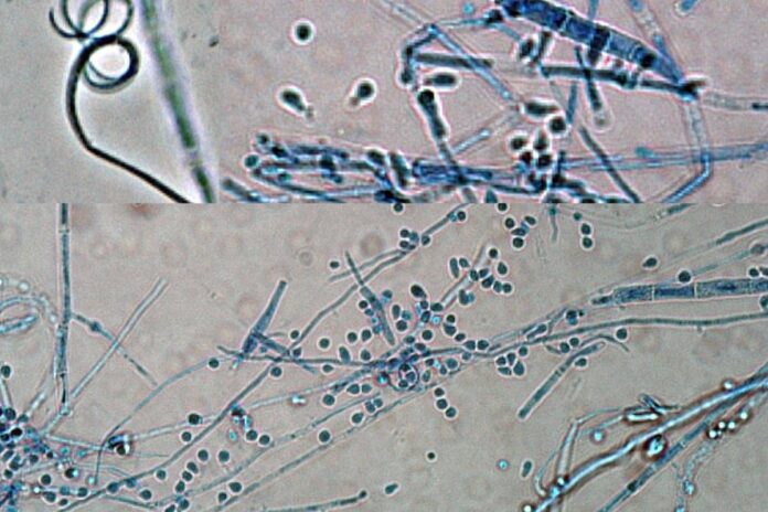 alta-em-casos-de-superfungo-que-causa-lesoes-na-virilha-acendem-alerta