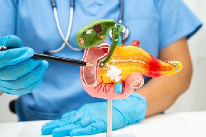 diabetes-repentina-apos-os-50-anos-pode-sinalizar-cancer-de-pancreas