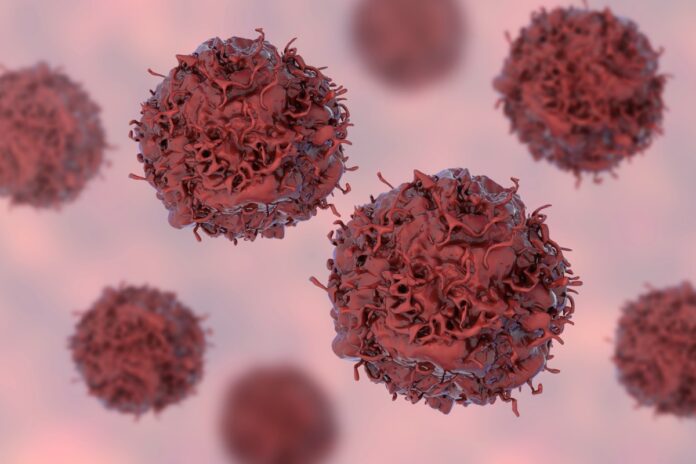 40%-dos-casos-de-cancer-poderiam-ser-evitados,-afirma-relatorio-da-oms