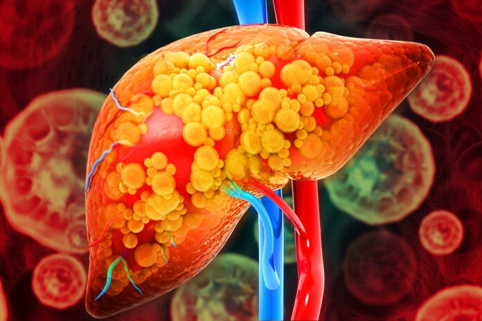 composto-intestinal-pode-ajudar-a-proteger-figado,-aponta-estudo