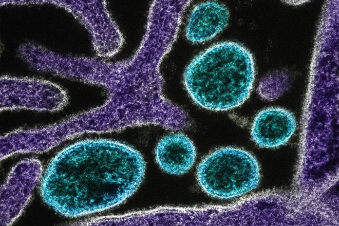 oms-confirma-morte-por-virus-nipah-em-bangladesh