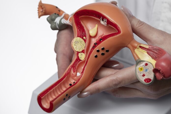 estudo-explica-por-que-o-cancer-de-ovario-desafia-o-tratamento