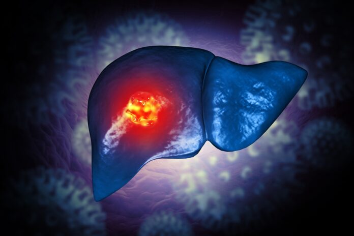 estudo-sugere-que-comer-menos-proteina-pode-atrasar-o-cancer-de-figado