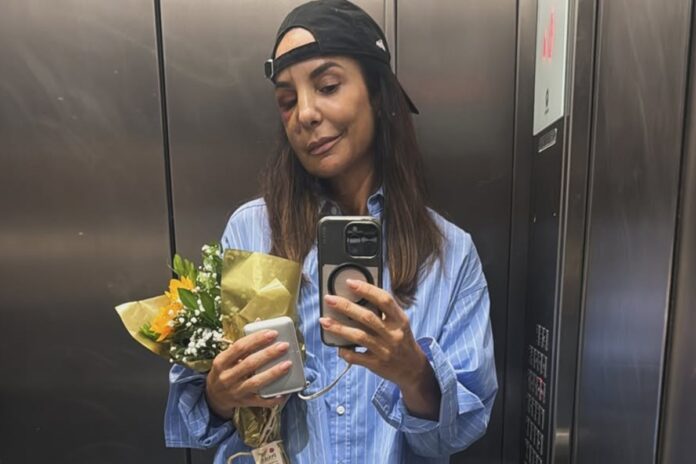 ivete-sangalo-confirma-show-no-bbb-26-dias-apos-cirurgia-no-rosto