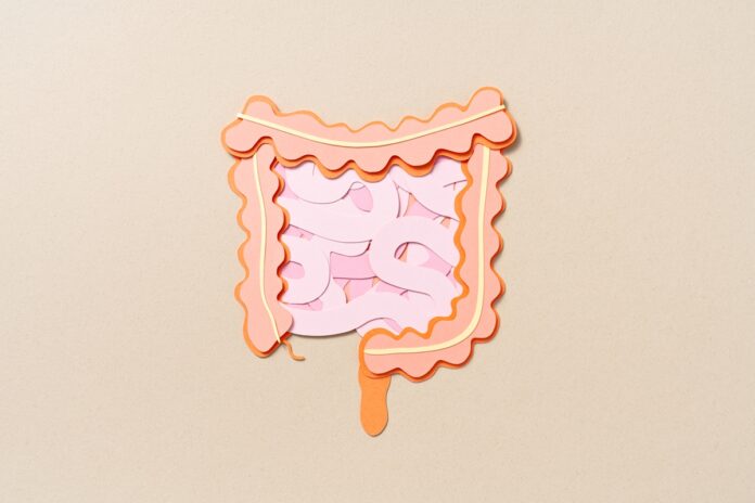 combinacao-de-2-polipos-eleva-em-5-vezes-o-risco-de-cancer-intestinal