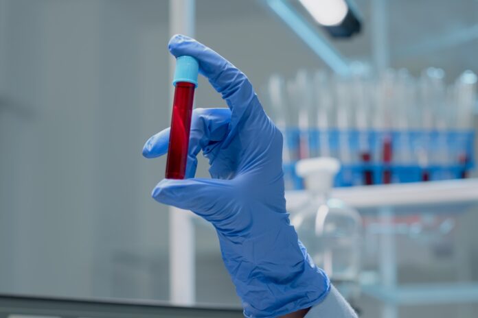 estudo-brasileiro-cria-exame-de-sangue-para-detectar-cancer-de-mama