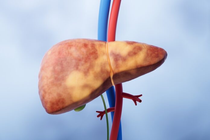cancer-de-figado:-geneticista-alerta-para-sintomas