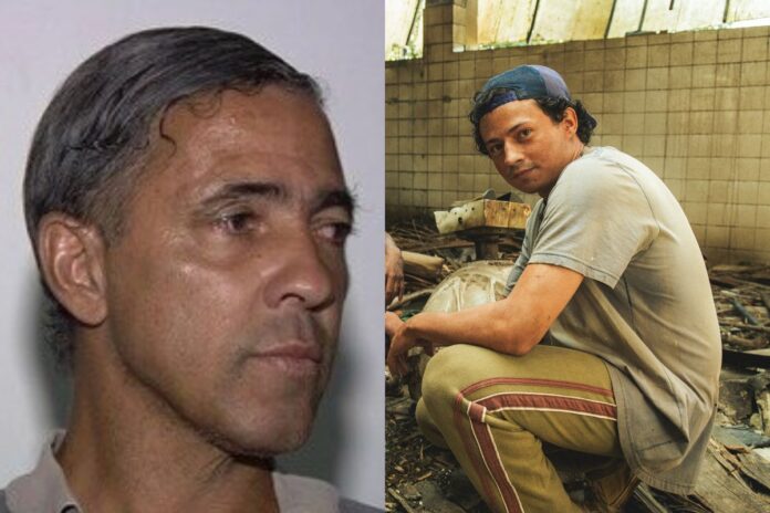 vitima-do-cesio-137-em-goiania-teve-braco-amputado-como-na-serie?