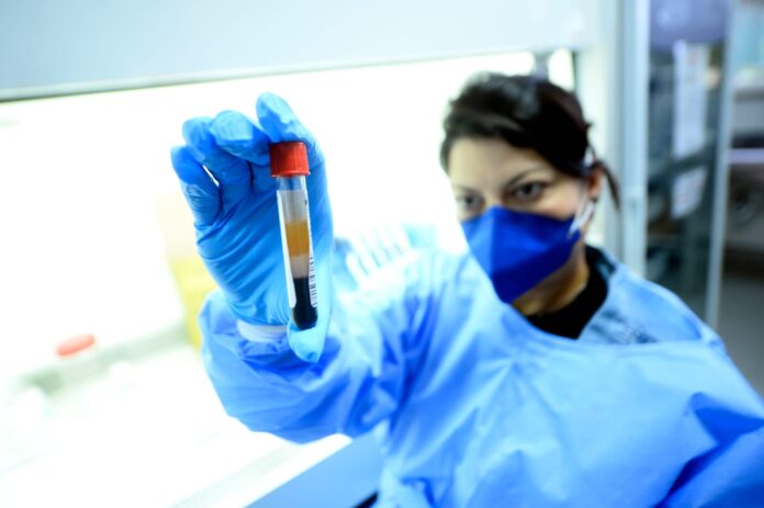 exames-de-alta-precisao-chegam-a-rede-publica-do-df-e-mudam-rotina-de-atendimentos