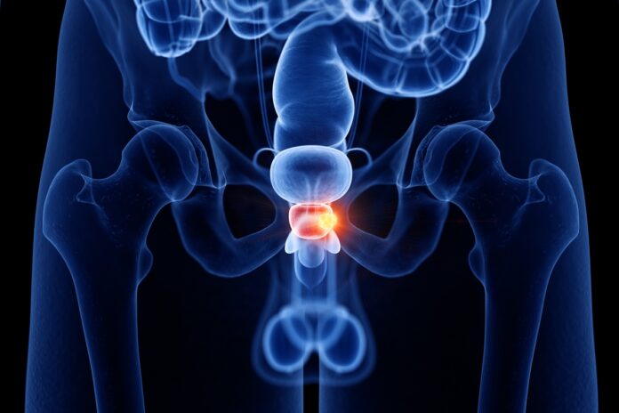 hiperplasia-da-prostata-pode-aumentar-a-frequencia-urinaria-dos-homens