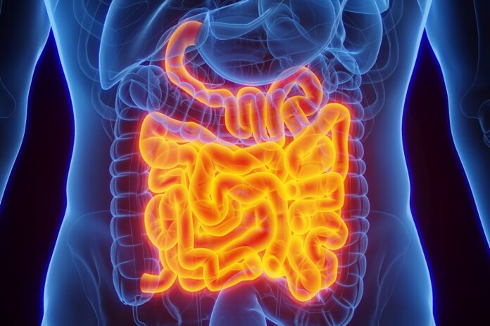 sintomas-que-podem-ser-causados-pela-sindrome-do-intestino-irritavel