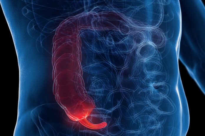gastro-explica-como-reconhecer-os-principais-sintomas-da-apendicite