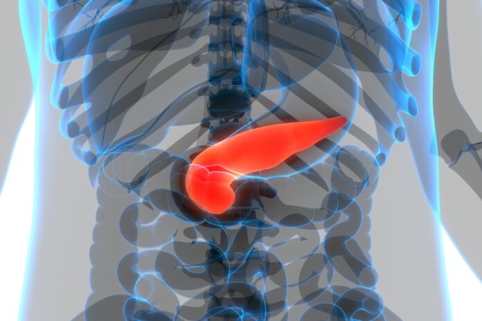 ia-identifica-sinais-de-cancer-de-pancreas-anos-antes-do-diagnostico