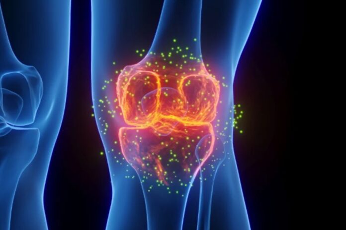 estudo-testa-injecao-que-pode-reverter-osteoartrite