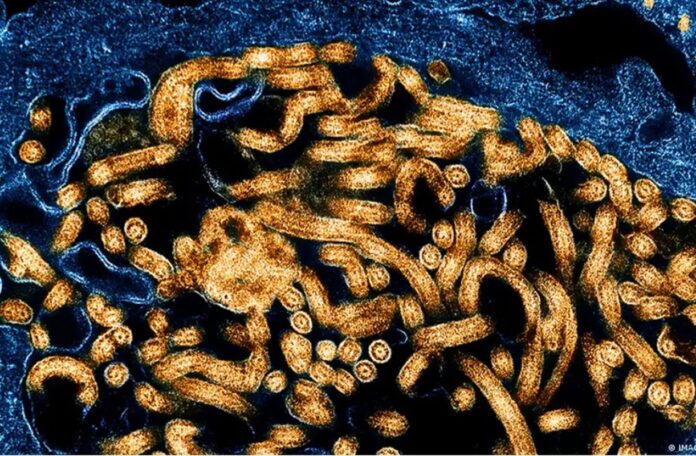 uganda-confirma-mais-dois-casos-de-ebola-e-total-sobe-para-sete