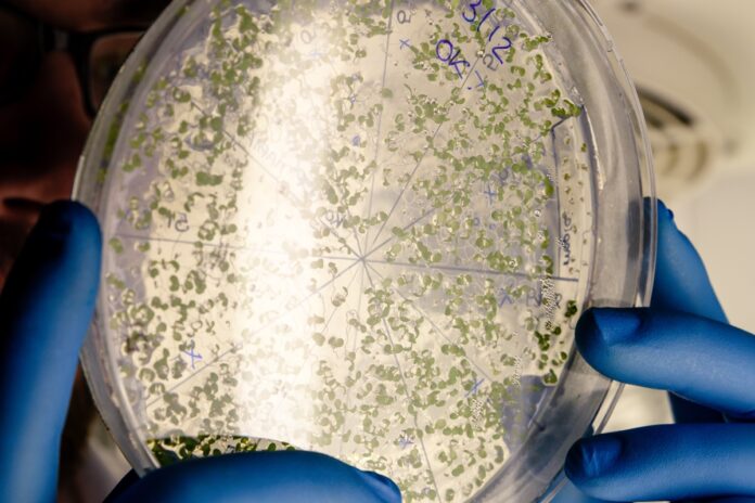 saiba-como-bacteria-do-caso-ype-e-crystal-sobrevive-a-agua-e-ao-sabao