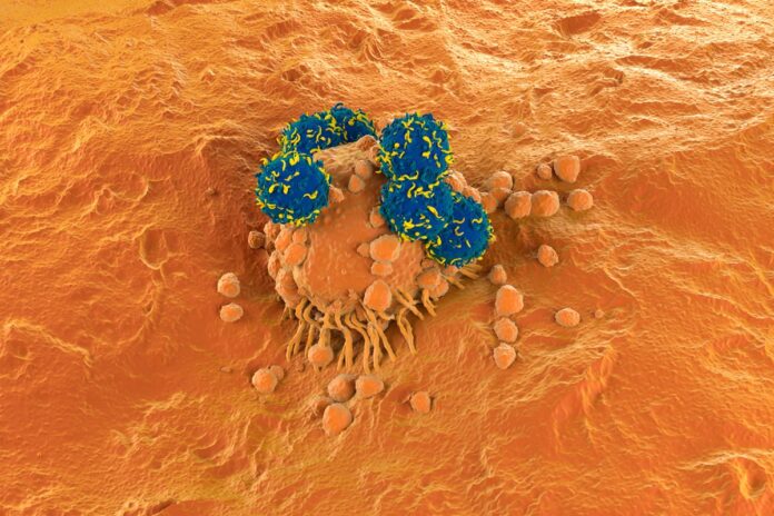 pesquisa-brasileira-com-car-t-chega-a-87,5%-de-eficacia-contra-cancer
