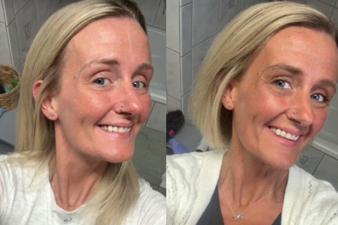 bronzeado-sem-sol:-peptideo-ilegal-ganha-espaco-nas-redes-sociais