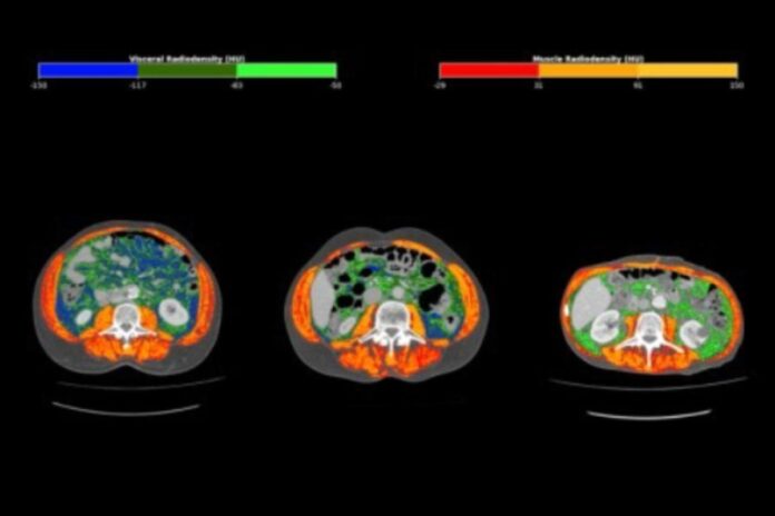 estudo-identifica-marcador-para-prever-evolucao-do-cancer-de-estomago