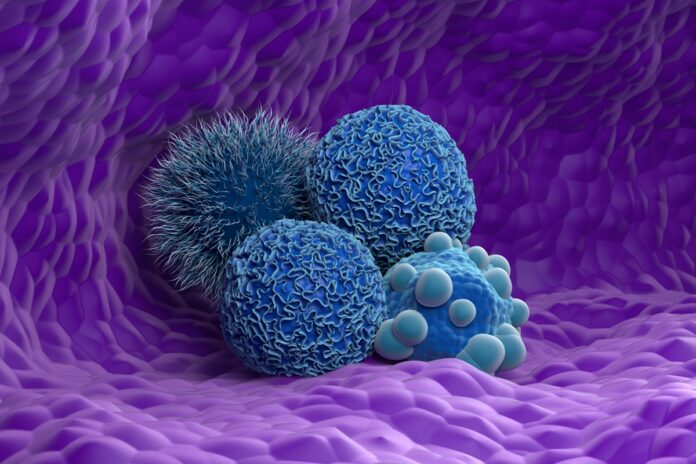 acucar-comum-pode-favorecer-disseminacao-de-cancer-de-ovario
