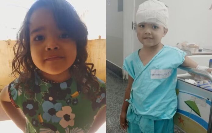 go:-menina-de-4-anos-e-atacada-na-cabeca-por-pit-bull-dentro-de-casa