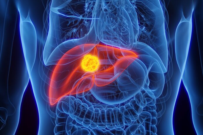 novo-exame-de-dna-pode-identificar-cancer-e-doenca-hepatica-no-inicio