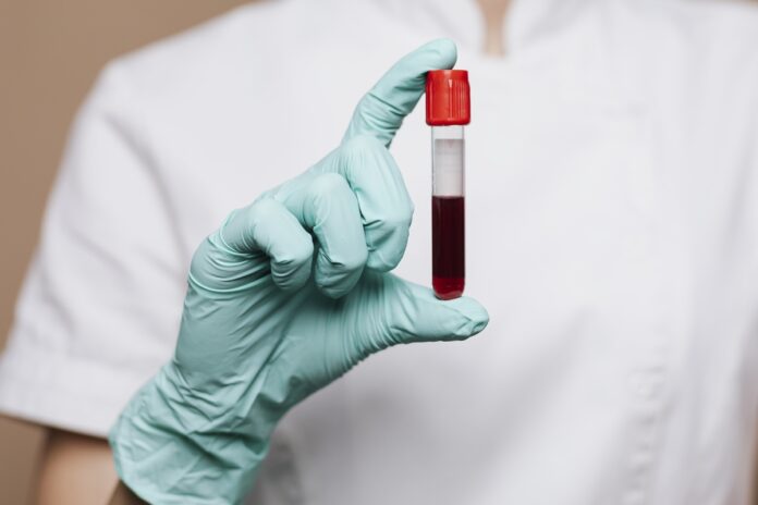 estudo-investiga-se-ha-risco-de-transmissao-do-alzheimer-pelo-sangue