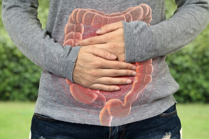 cancer-de-intestino-antes-dos-50-tem-tumor-diferente-e-maior-sobrevida