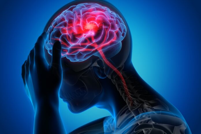 novo-tratamento-injetavel-pode-ajudar-o-cerebro-a-se-recuperar-apos-avc
