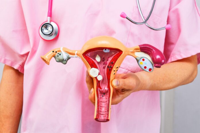 planos-de-saude-passam-a-cobrir-diu-hormonal-para-pessoas-com-endometriose