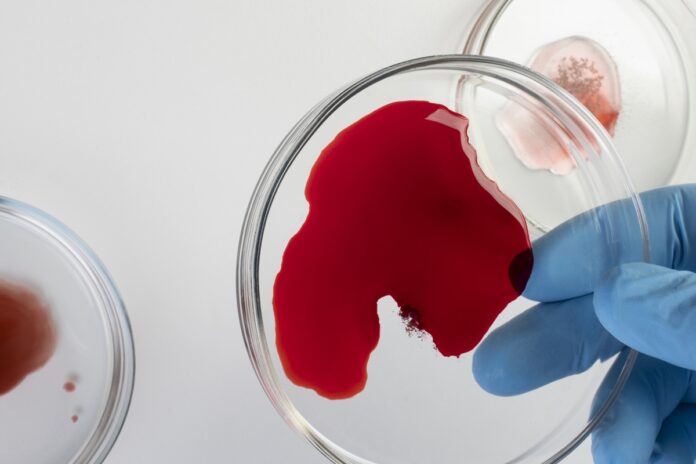 jejum-antes-do-exame-de-sangue-pode-nao-fazer-diferenca,-sugere-estudo